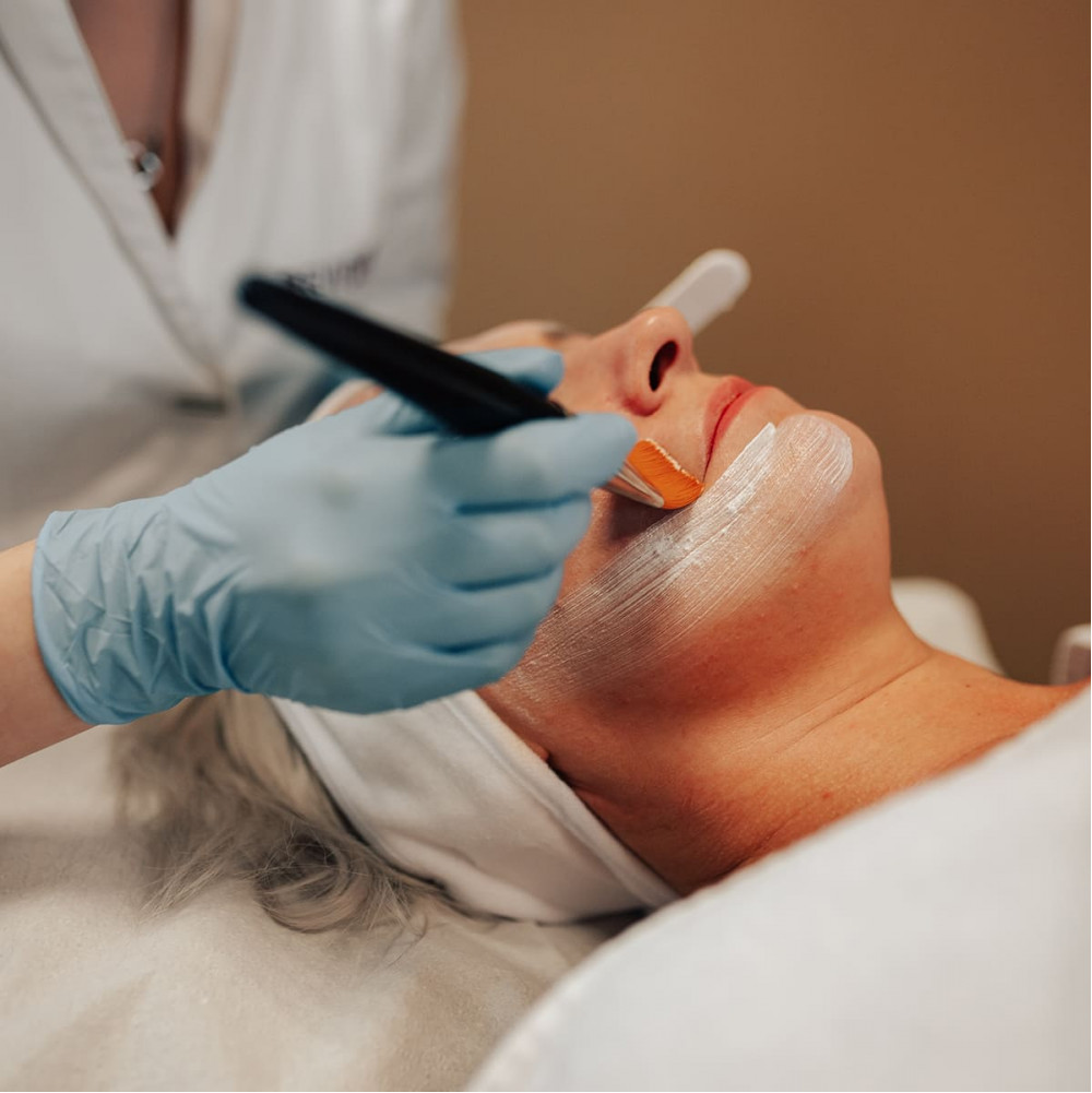 Peel Treatment: an exfoliating treatment