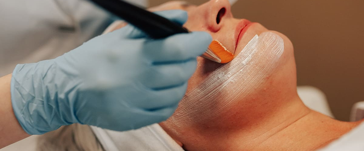 Peel Treatment: a treatment that exfoliates dead skin cells and stimulates skin regeneration Peel Treatment: a treatment that exfoliates dead skin cells and stimulates skin regeneration